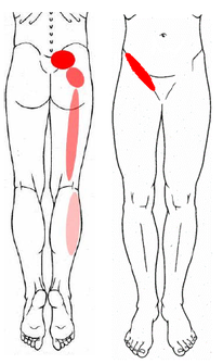Sacroiliac joint referred pain pattern from buttock down lateral leg